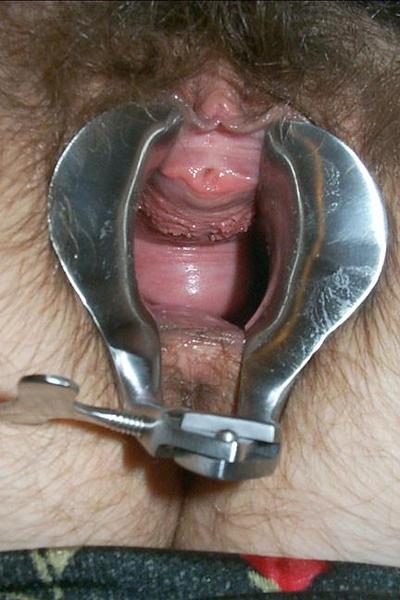 15P extreme fisting and pussy insertions