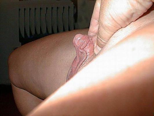 17P Real huge clitoris