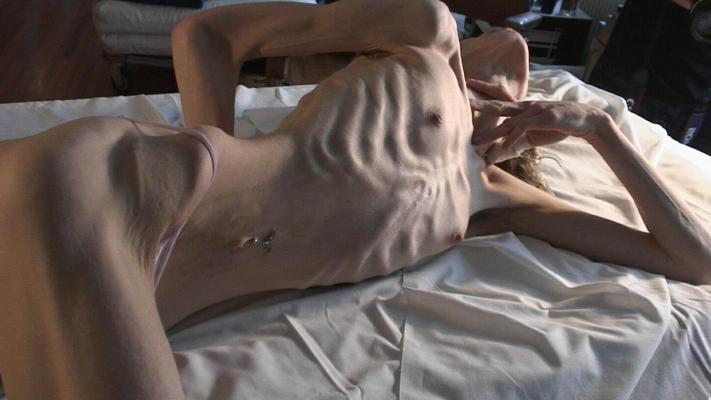 15P Skinny girls