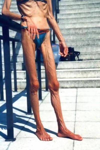 16P very skinny ladies poser