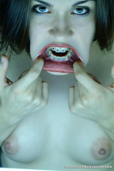 16P Cute brunette teen with braces stretches her mouth wide open