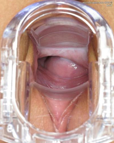 15P Petite teen babe spreads and inserts speculum in her puffy pussy