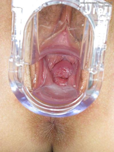 15P Teen toys and spreads fuzzy pussy with speculum