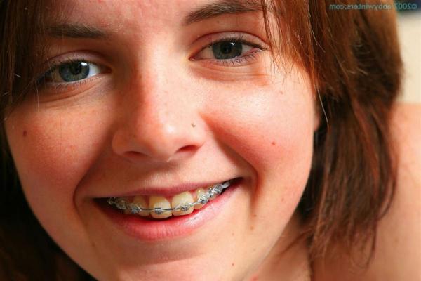 16P Amateur-Teenager mit Zahnspange fingert ihre fleischigen Schamlippen