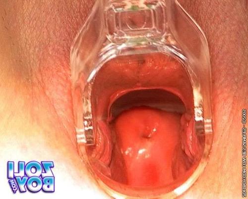 16P Nanette gets fingered and inserts speculum