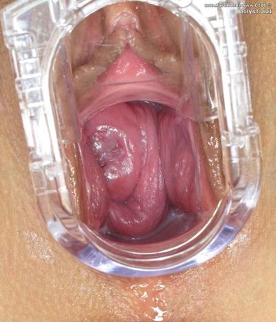 15P Busty babe toys asshole and spreads with speculum