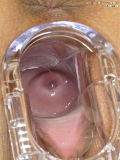 15P Beautiful Peaches toys with dildo and speculum