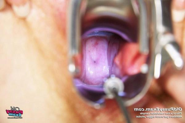 15P Mature redhead Olga gyno fetish speculum examination by kinky doctor