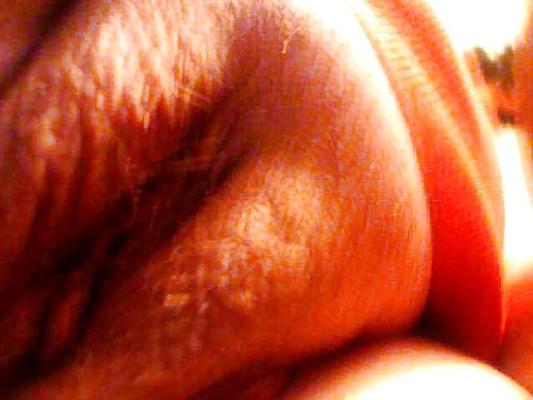18P Lorenda's fat pudgy BBW pussy shots and tit's.