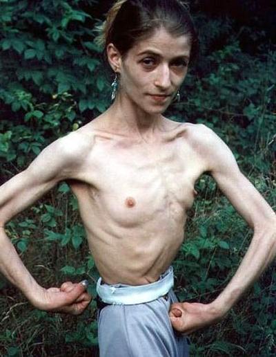 15P Skinny Hottie