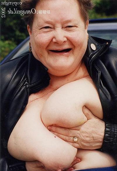 16P Nice OMA