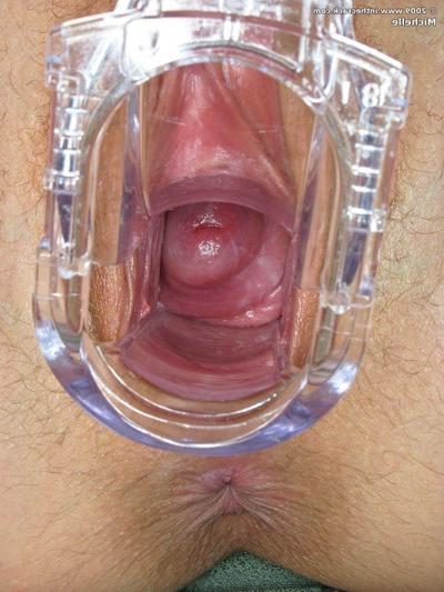 15P Teen babe toys fuzzy pussy with dildo and speculum