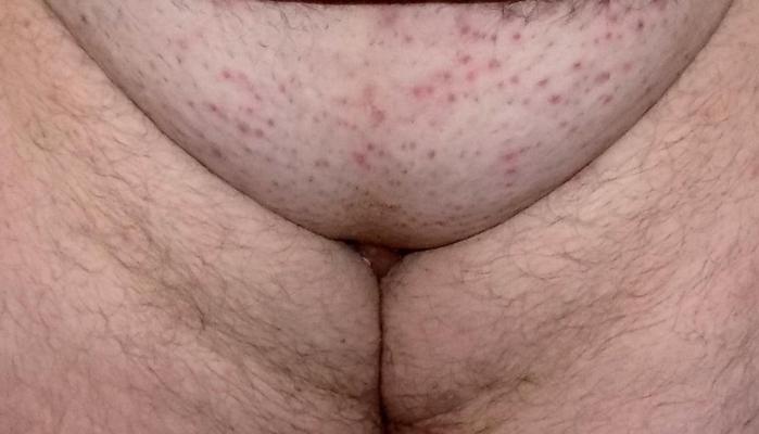 8P My pussy and my asshole want a big and hard cock to fuck me.