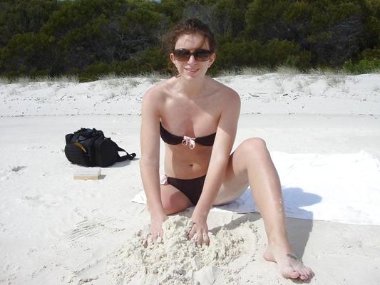 12P Amputee girl