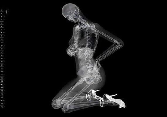 13P Erotic Calendar 13 - X-ray Calender 2010