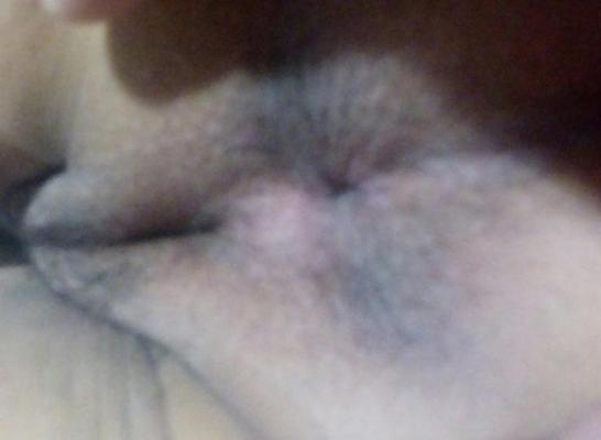 12P Anal