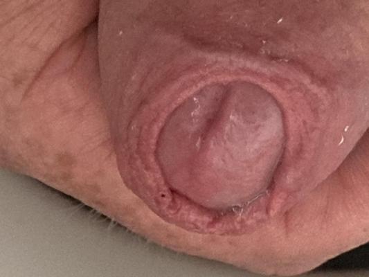 9P My cock