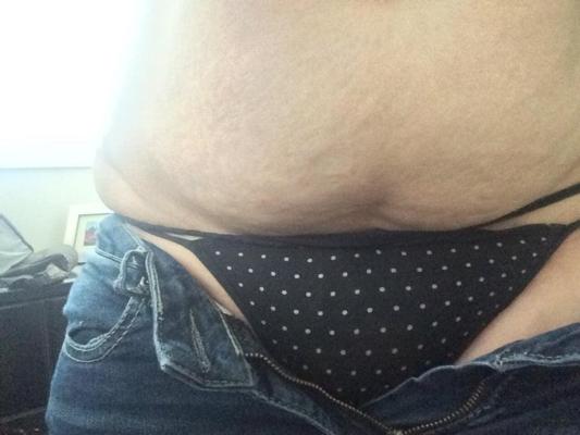 25P Thong exposed