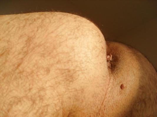 7P ASS TO LICK