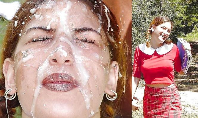 25P facial