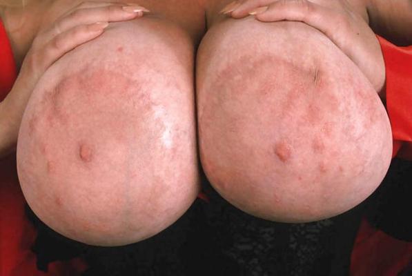 25P Random Nipple Mix