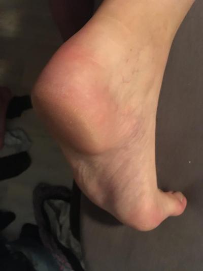 9P Feet GF