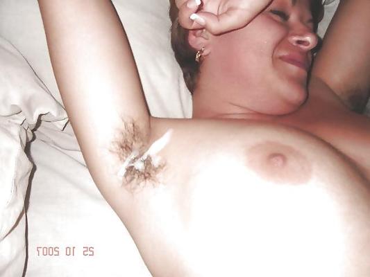 12P Armpit