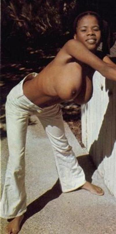 13P Old school breast