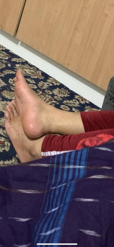 25P Pieds indiens amateurs