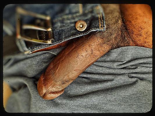 6P Pre-Op Trans clit exposed