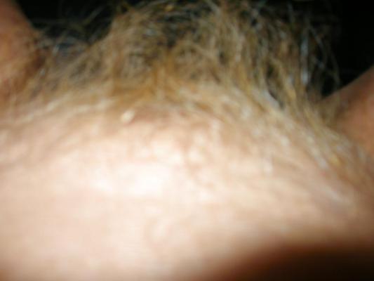 8P Ginger bush