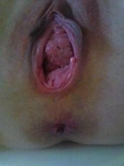 21P My EX Girlfriend self pussy pics.  Close up!