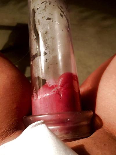 25P Perverted Pics 37