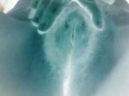 6P Weird hairy pics