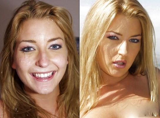 25P Before and After Facials