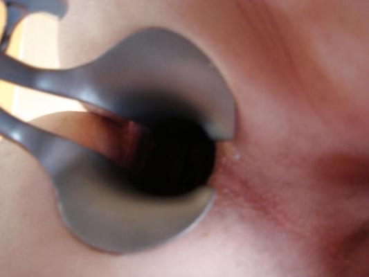 4P Speculum Spiele