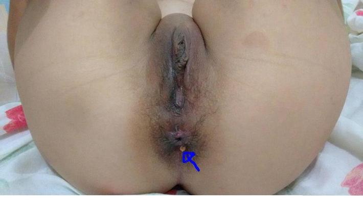25P Pussy &amp; Butthole 03